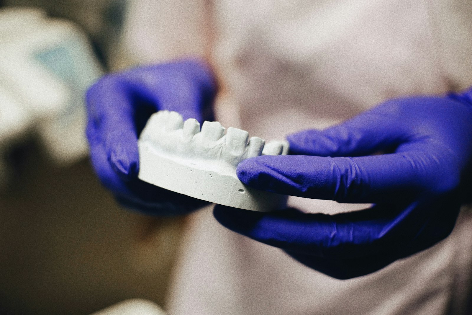 Mãos com luvas a segurar um modelo em gesso na DentalWeiss