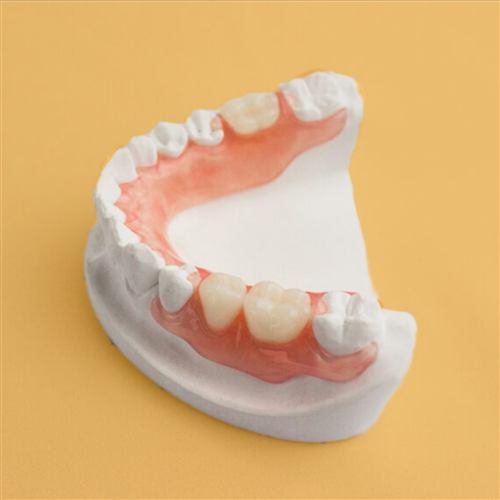 Prótese flexível sobre modelo dentário